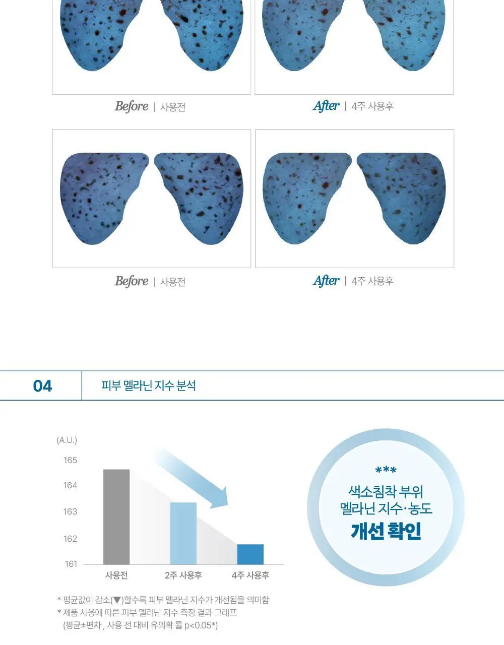 [기미패치] 라보타치 다크스팟 케어 패치 32매 상세페이지 29